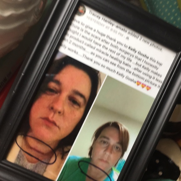 ❤️‍🩹🛍MIRACLE HEALING BALM #cureall, BEST IN BEAUTY PICK! #elevatedskincare - Picture 9 of 16